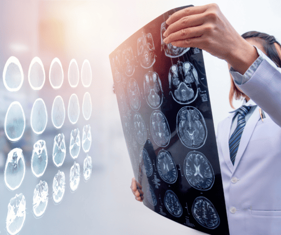 What Are The Advantages Of Hiring A TBI Traumatic Brain Injury