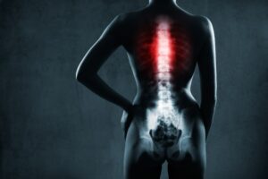 Spinal Cord Injury Lawyer Gainesville, GA