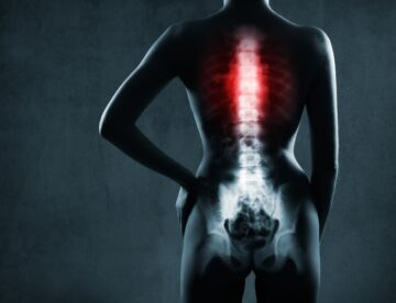 back injury lawyer Duluth, GA